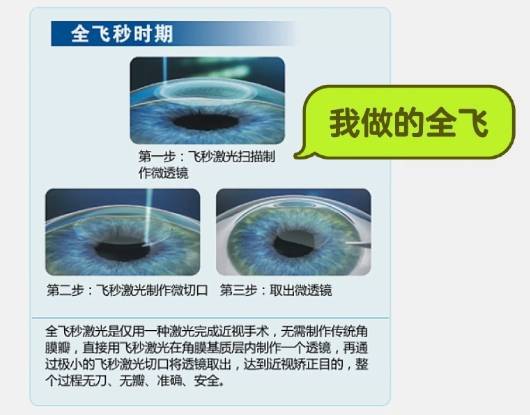 im电竞网址镇江全飞秒做完啦！保姆级分享想做的家人们看完这篇再行动哦！(图2)